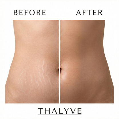 THALYVE™ Evolved Stretch Mark Stick
